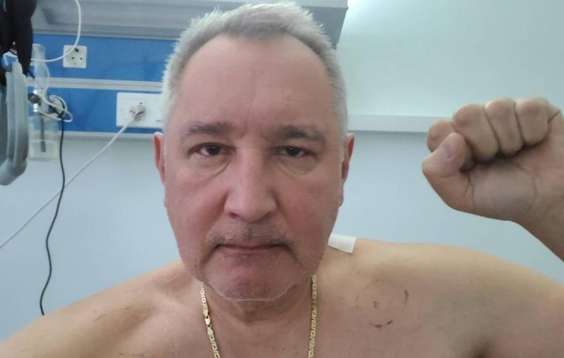 Рогозин опубликовал первое фото после операции