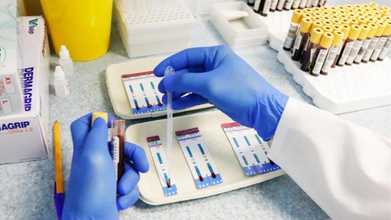 Эксперт отметил снижение заболеваемости ВИЧ-инфекцией в России