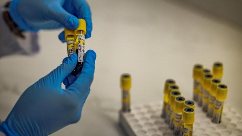 В ООН обратили внимание на угрозу новой эпидемии ВИЧ